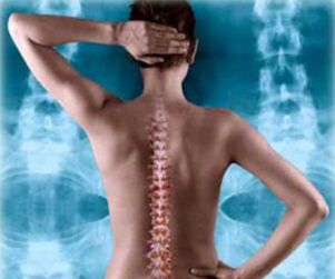 illustration de la colonne vertébrale