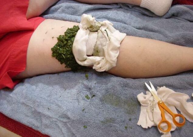 compresse pour l'arthrose de l'articulation du genou.