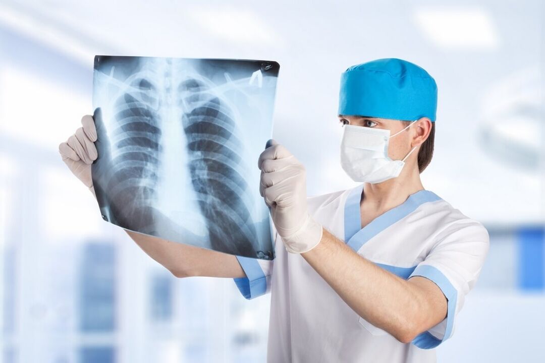 Radiographie de la poitrine avec ostéochondrose. 