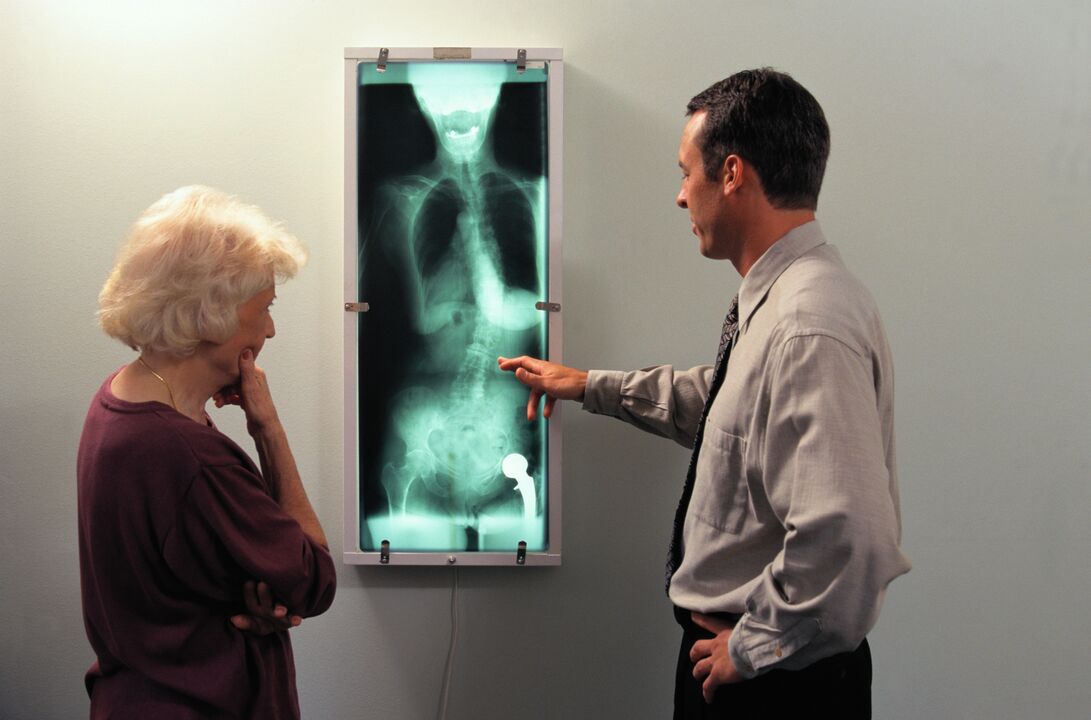 diagnostic radiologique pour les douleurs articulaires de la hanche